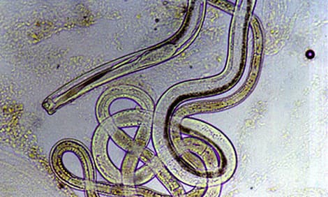 Nematodes, Capillaria, roundworms